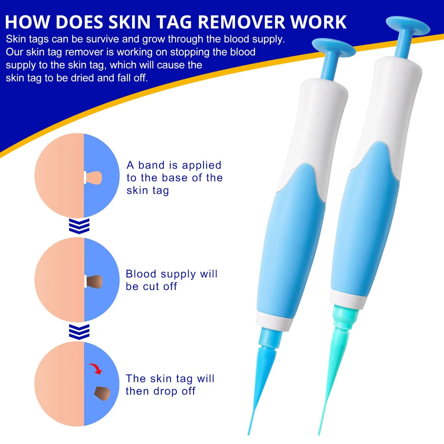 Auto Skin Tag Kit Painless Mole Wart Skin Tag Treatments Body Facial Beauty Tool